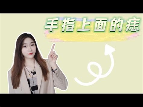 女生左手中指有痣|左手有痣的女生代表什么 女人左手有痣全图解